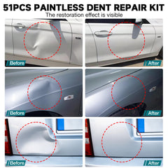 NJ FOREVER adjustable dent lifter showing paint-safe dent lifting.