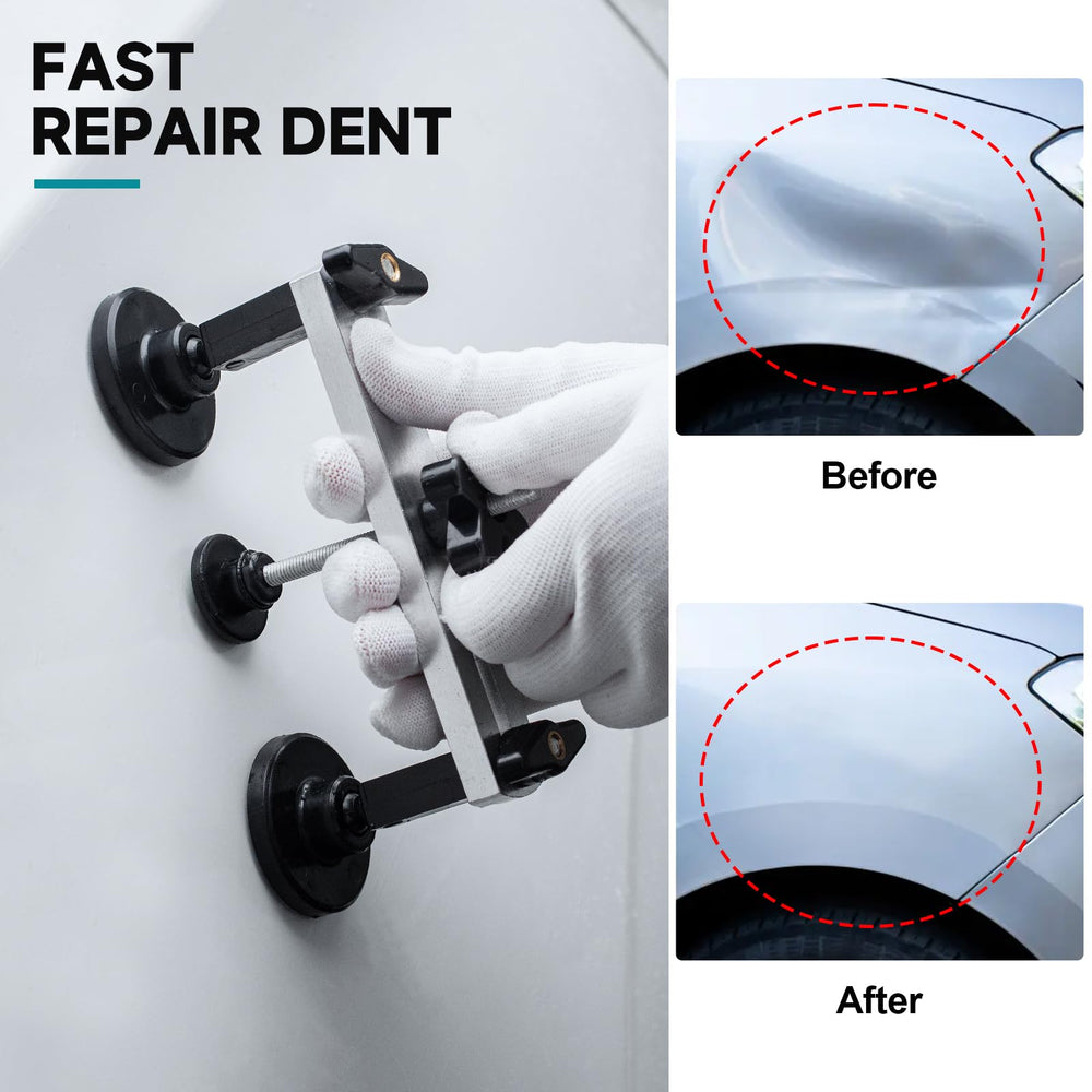 NJ FOREVER carry bag organizes the dent repair kit for mobile repairs.