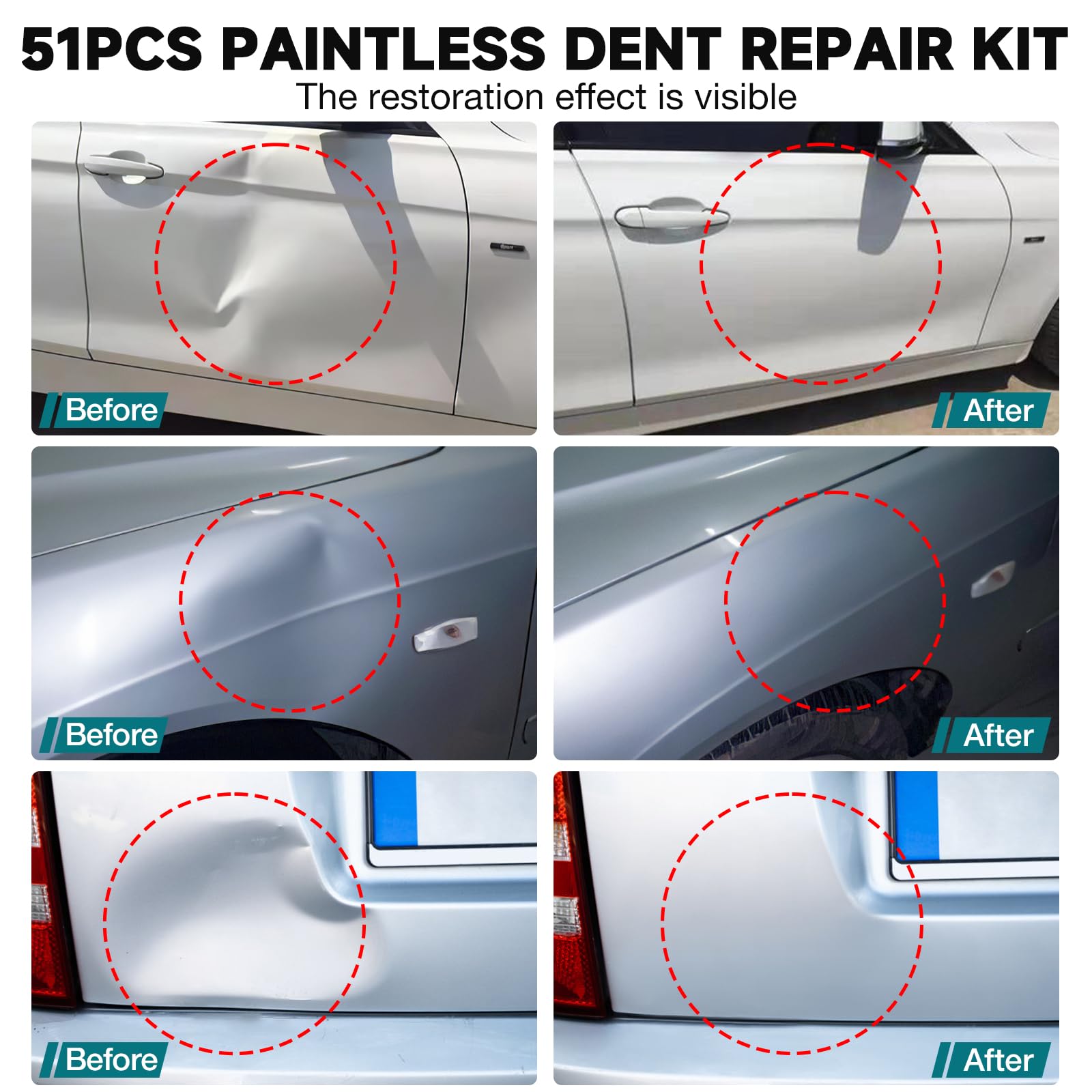 NJ FOREVER adjustable dent lifter showing paint-safe dent lifting.