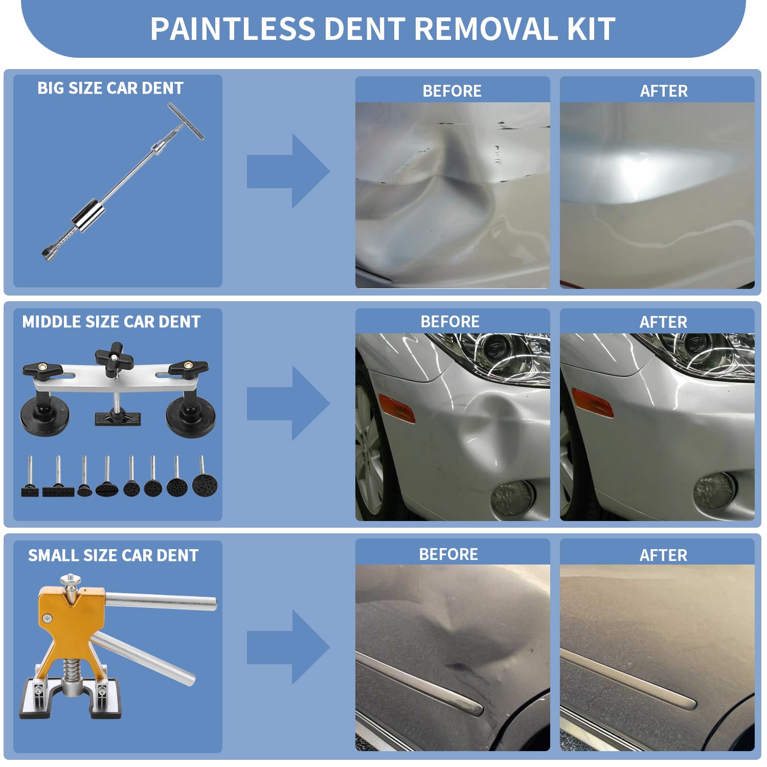 Noenoough gold dent lifter safely lifts mid-size dents
