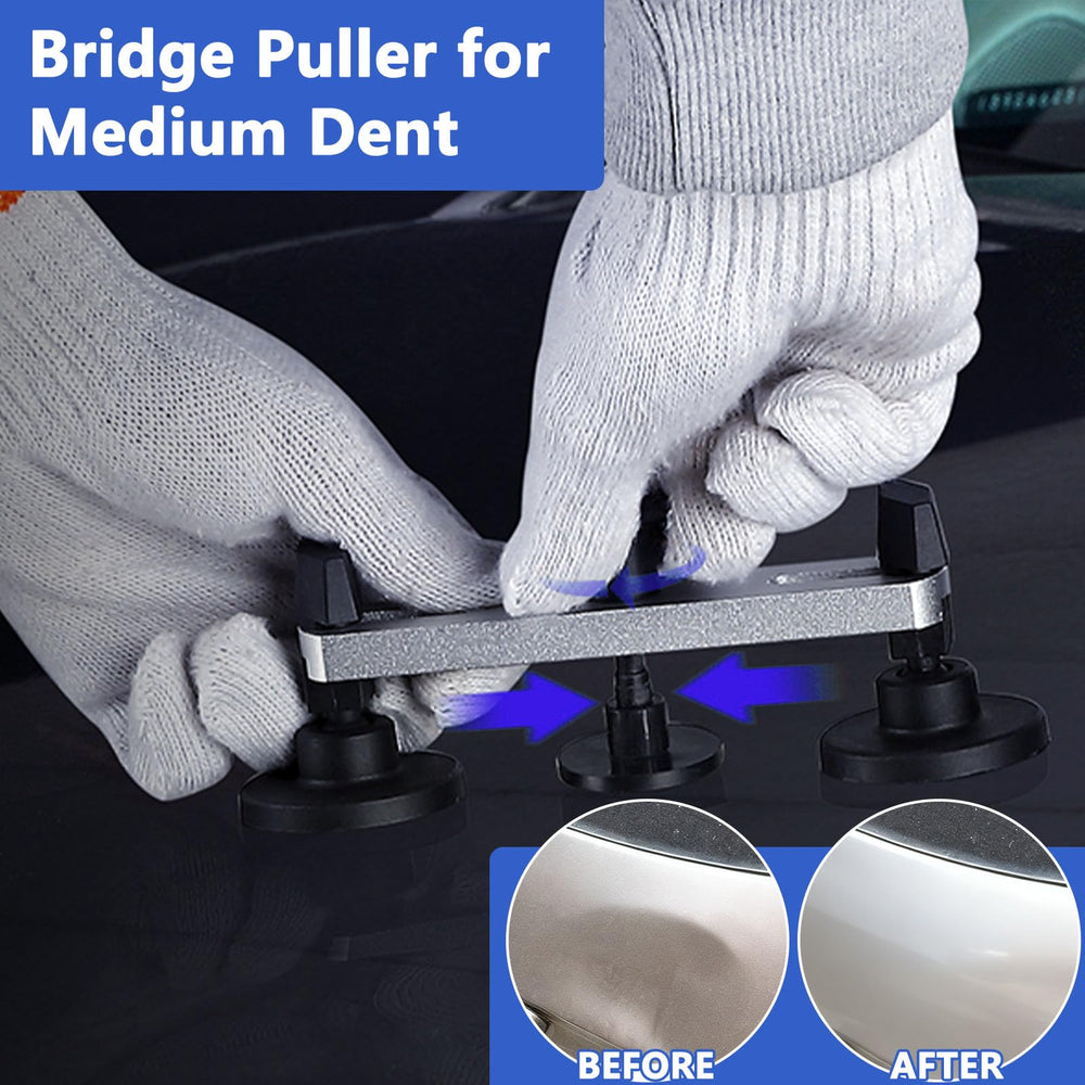 Poakkus large suction cup tackles bigger dents safely.